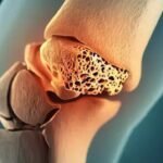Osteopatía