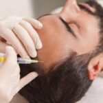 Aplicación capilar (alopecia)