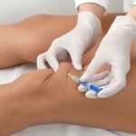 Terapia neural