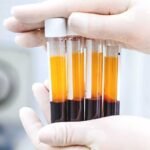 Suero de plasma rico en plaquetas