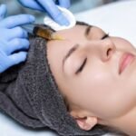 Infiltración intradérmica (mesoterapia)
